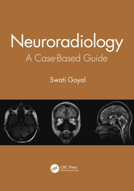 Swati Goyal - Neuroradiology, E-bok. Tillgänglighet: Lägg i varukorg