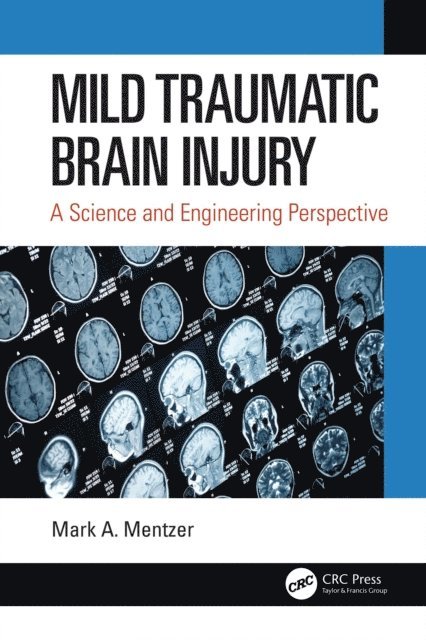 Mark A. Mentzer - Mild Traumatic Brain Injury, E-bok. Tillgänglighet: Lägg i varukorg