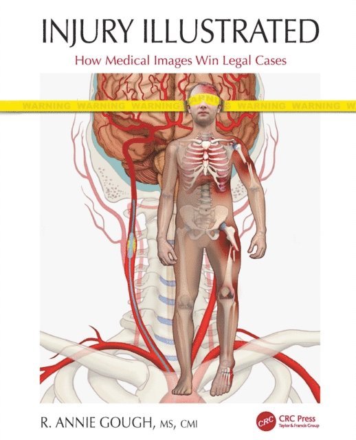 R. Annie Gough - Injury Illustrated, E-bok. Tillgänglighet: Lägg i varukorg