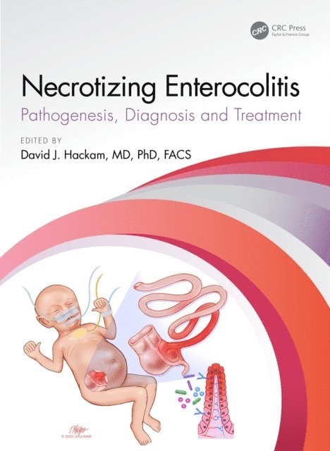 David J. Hackam - Necrotizing Enterocolitis, E-bok