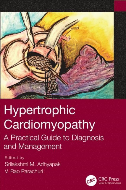 V. Rao Parachuri, Srilakshmi M. Adhyapak - Hypertrophic Cardiomyopathy, E-bok