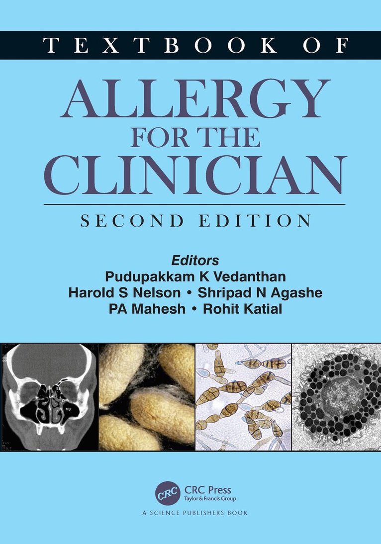 Pudupakkam K. Vedanthan, Harold S. Nelson, Shripad N. Agashe, PA Mahesh, Rohit Katial - Textbook of Allergy for the Clinician, E-bok