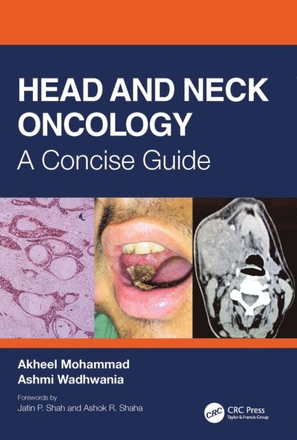 Ashmi Wadhwania, Akheel Mohammad - Head and Neck Oncology, E-bok. Tillgänglighet: Lägg i varukorg