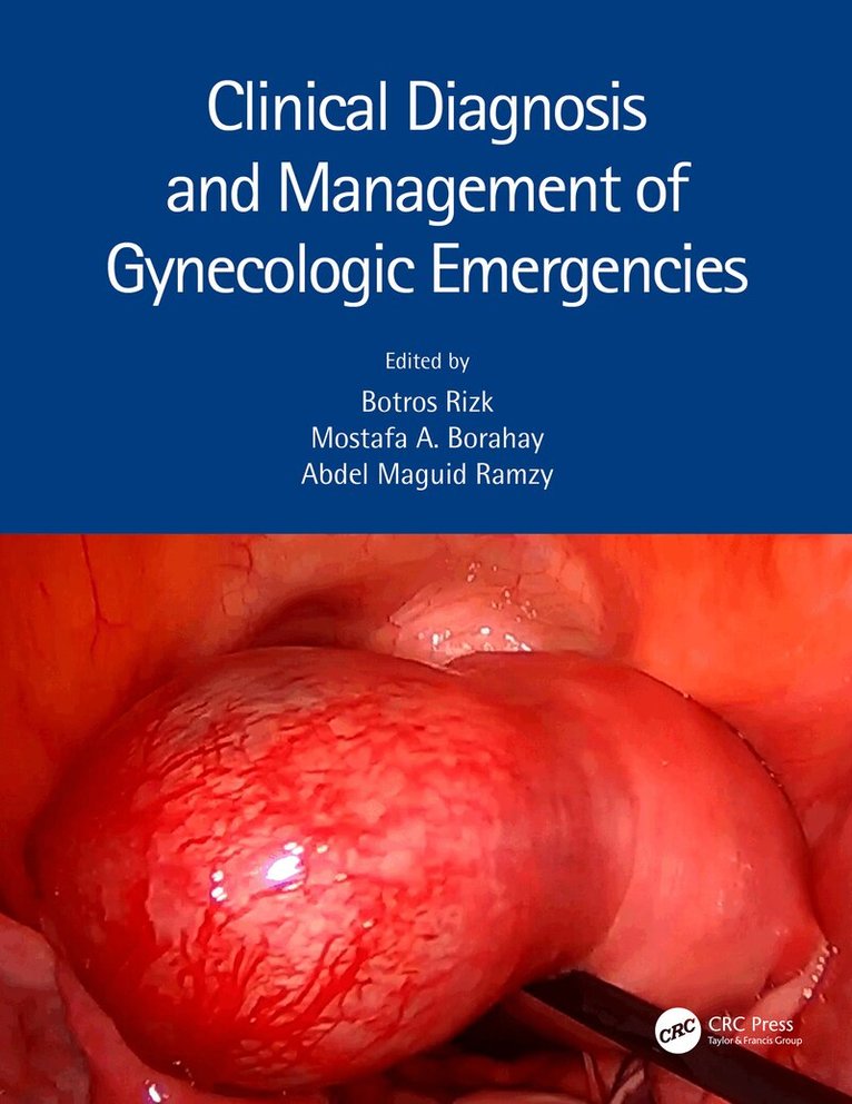 Botros Rizk, Mostafa A. Borahay, Abdel Maguid Ramzy - Clinical Diagnosis and Management of Gynecologic Emergencies, E-bok