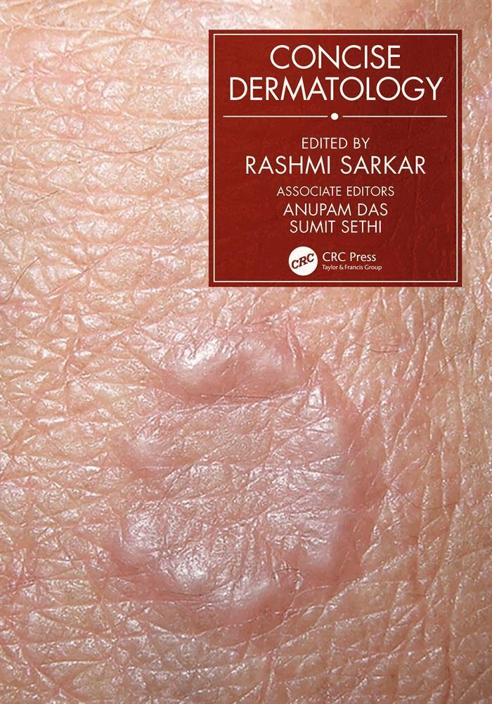 Rashmi Sarkar - Concise Dermatology, E-bok