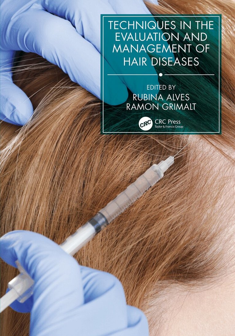 Ramon Grimalt, Rubina Alves - Techniques in the Evaluation and Management of Hair Diseases, E-bok