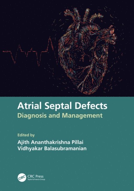 Vidhyakar Balasubramanian, Ajith Ananthakrishna Pillai - Atrial Septal Defects, E-bok. Tillgänglighet: Lägg i varukorg