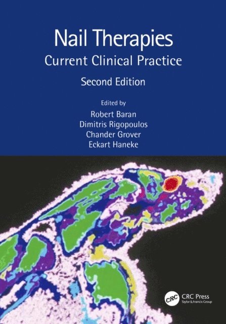 Eckart Haneke, Chander Grover, Dimitris Rigopoulos, Robert Baran - Nail Therapies, E-bok