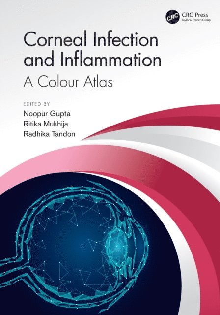 Radhika Tandon, Ritika Mukhija, Noopur Gupta - Corneal Infection and Inflammation, E-bok