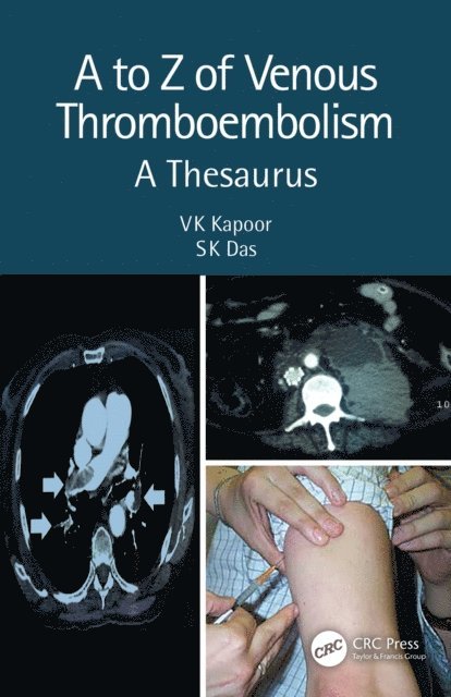 SK Das, VK Kapoor - to Z of Venous Thromboembolism, E-bok. Tillgänglighet: Lägg i varukorg