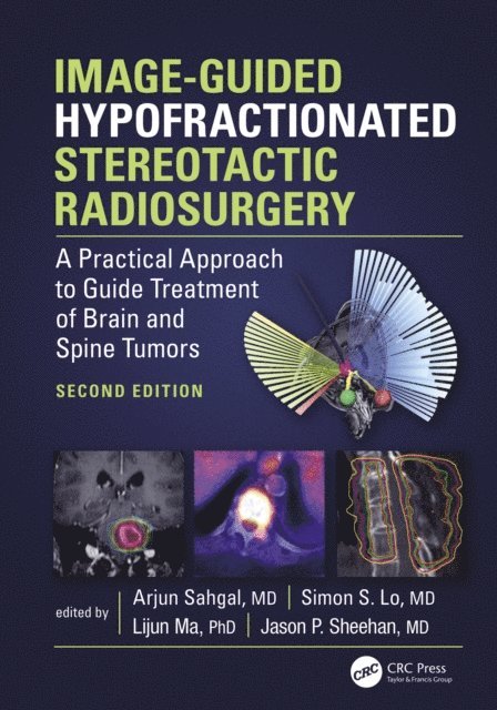 Arjun Sahgal - Image-Guided Hypofractionated Stereotactic Radiosurgery, E-bok