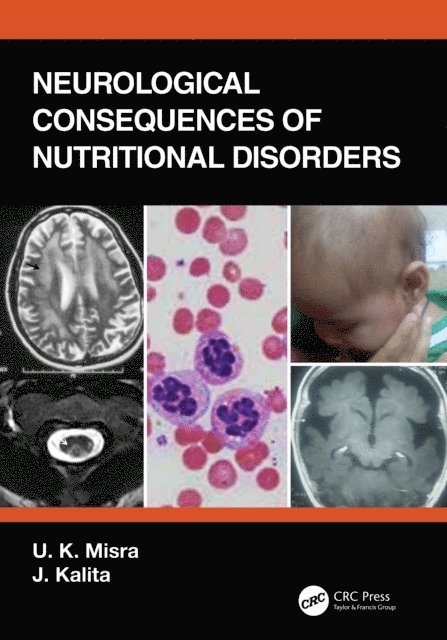 J. Kalita, U. K. Misra - Neurological Consequences of Nutritional Disorders, E-bok. Tillgänglighet: Lägg i varukorg