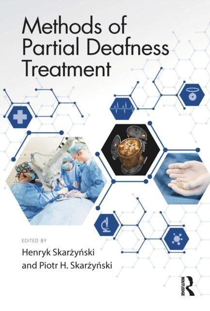 Piotr H. Skarzynski, Henryk Skarzynski - Methods of Partial Deafness Treatment, E-bok