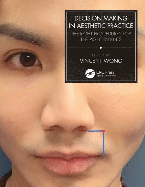 Vincent Wong - Decision Making in Aesthetic Practice, E-bok