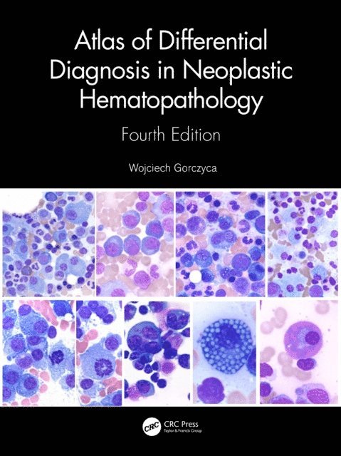 Wojciech Gorczyca - Atlas of Differential Diagnosis in Neoplastic Hematopathology, E-bok