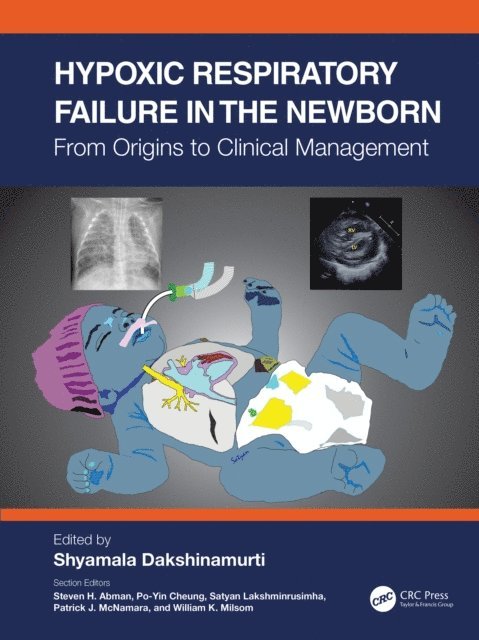 Shyamala Dakshinamurti - Hypoxic Respiratory Failure in the Newborn, E-bok