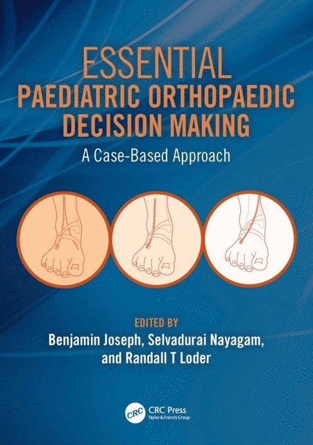 Randall Loder, Selvadurai Nayagam, Benjamin Joseph - Essential Paediatric Orthopaedic Decision Making, E-bok