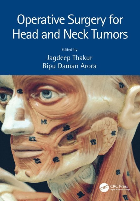 Ripu Daman Arora, Jagdeep Thakur - Operative Surgery for Head and Neck Tumors, E-bok. Tillgänglighet: Lägg i varukorg