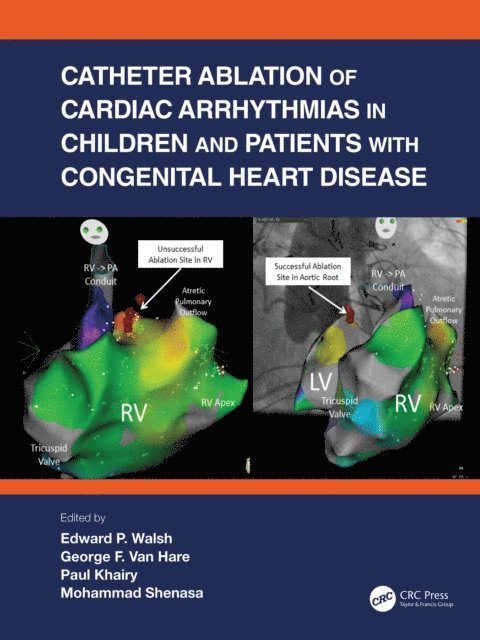 Mohammad Shenasa, Paul Khairy, George F. Van Hare, Edward P. Walsh - Catheter Ablation of Cardiac Arrhythmias in Children and Patients with Congenital Heart Disease, E-bok