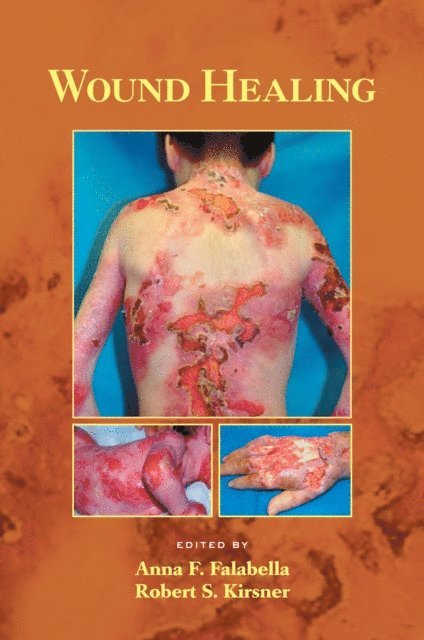 Robert Kirsner, Anna Falabella - Wound Healing, E-bok
