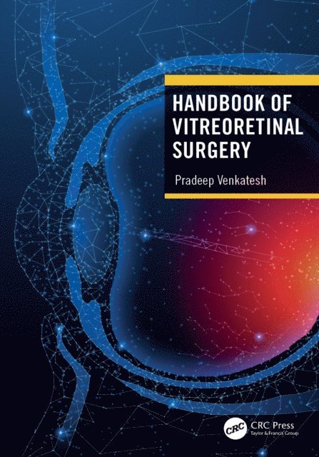 Pradeep Venkatesh - Handbook of Vitreoretinal Surgery, E-bok. Tillgänglighet: Lägg i varukorg