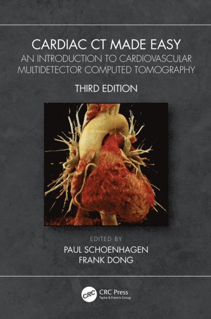 Frank Dong, Paul Schoenhagen - Cardiac CT Made Easy, E-bok