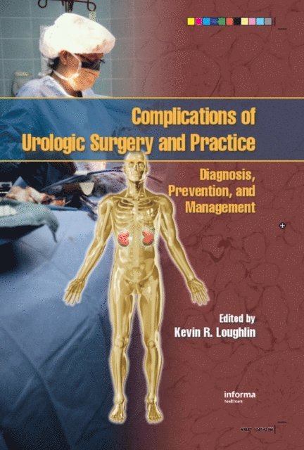 Kevin R. Loughlin - Complications of Urologic Surgery and Practice, E-bok