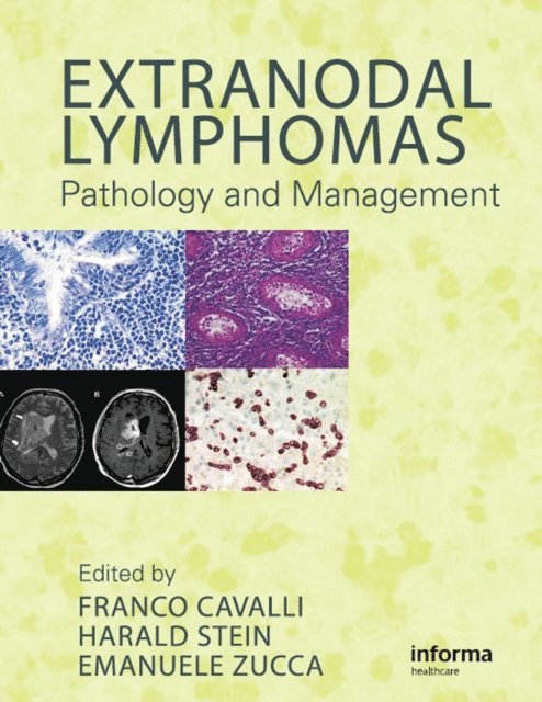 Emanuele Zucca, Harald Stein, Franco Cavalli - Extranodal Lymphomas, E-bok