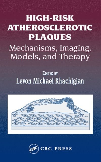 Levon Michael Khachigian - High-Risk Atherosclerotic Plaques, E-bok. Tillgänglighet: Lägg i varukorg