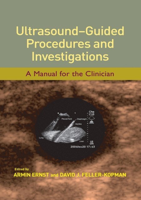 David J. Feller-Kopman, Armin Ernst - Ultrasound-Guided Procedures and Investigations, E-bok