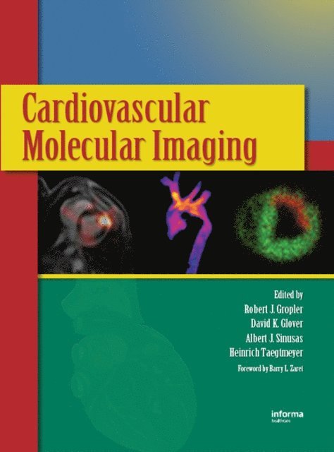 Albert J. Sinusas, David K. Glover, Robert J. Gropler - Cardiovascular Molecular Imaging, E-bok