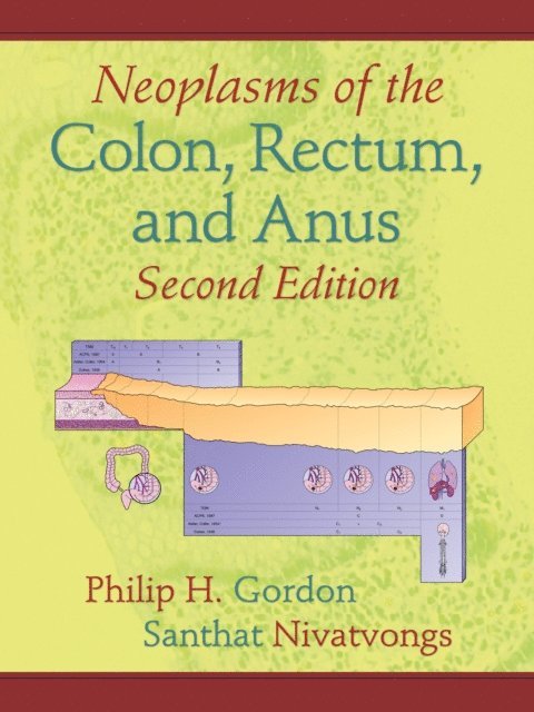 Santhat Nivatvongs, Philip H. Gordon - Neoplasms of the Colon, Rectum, and Anus, E-bok