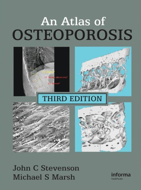 Michael S. Marsh, John C. Stevenson - Atlas of Osteoporosis, E-bok