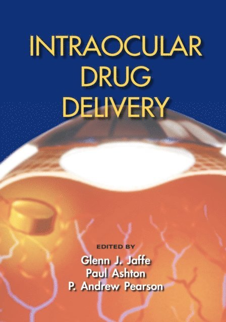 P. Andrew Pearson, Paul Ashton, Glenn J. Jaffe - Intraocular Drug Delivery, E-bok