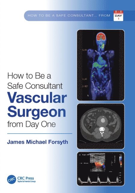 James Forsyth - How to be a Safe Consultant Vascular Surgeon from Day One, E-bok