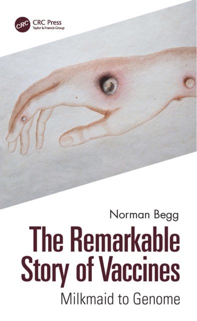 Norman Begg - Remarkable Story of Vaccines, E-bok
