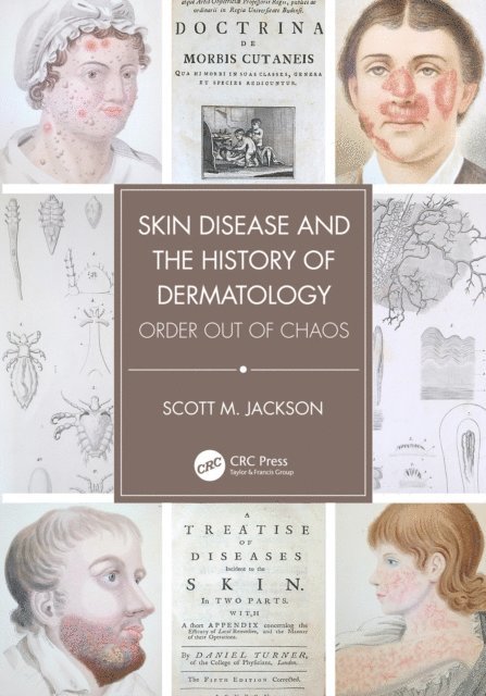 Scott Jackson - Skin Disease and the History of Dermatology, E-bok