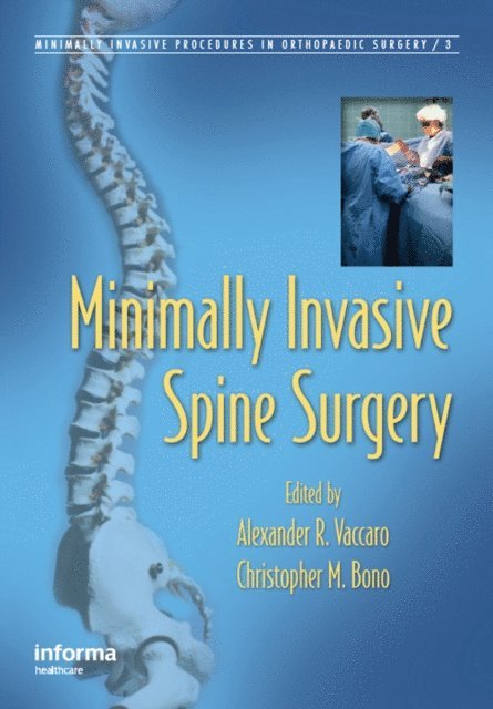 Christopher M. Bono, Alexander R. Vaccaro - Minimally Invasive Spine Surgery, E-bok