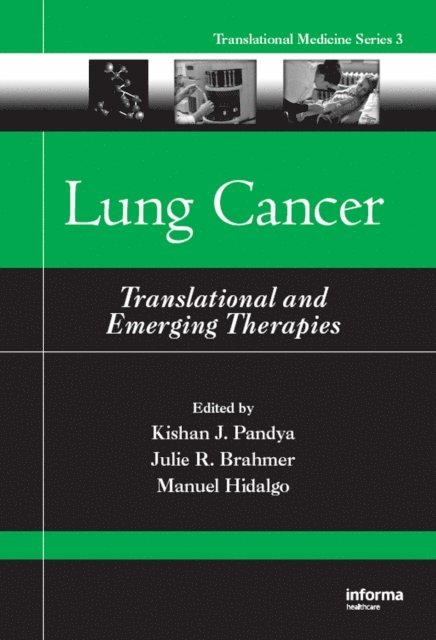 Manuel Hidalgo, Julie R. Brahmer, Kishan J. Pandya - Lung Cancer, E-bok. Tillgänglighet: Lägg i varukorg