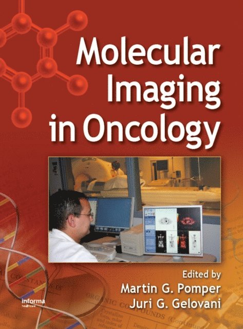 Juri G. Gelovani, Martin G. Pomper - Molecular Imaging in Oncology, E-bok