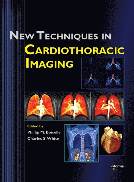 Charles S. White, Phillip M. Boiselle - New Techniques in Cardiothoracic Imaging, E-bok