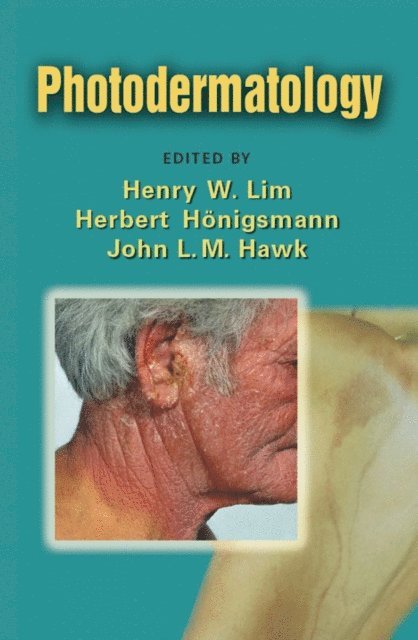 John L. M. Hawk, Herbert Honigsmann, Henry W. Lim - Photodermatology, E-bok