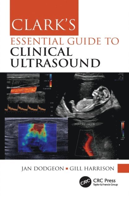 Gill Harrison, Jan Dodgeon - Clark's Essential Guide to Clinical Ultrasound, E-bok