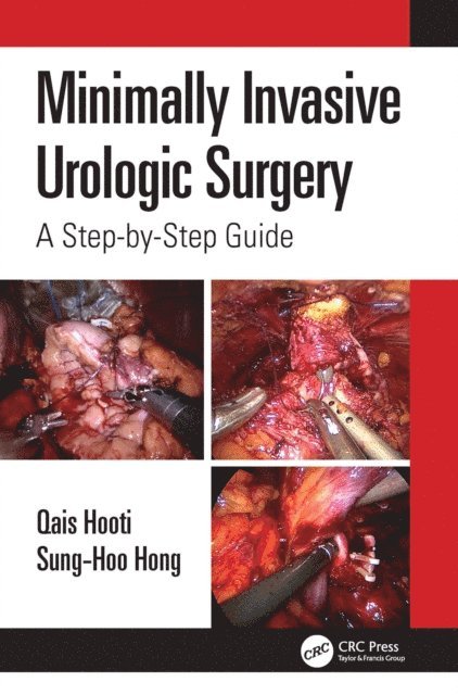 Minimally Invasive Urologic Surgery