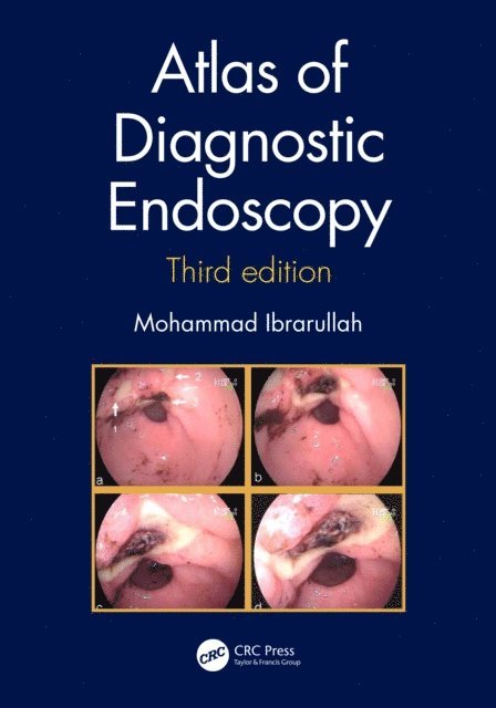 Mohammad Ibrarullah - Atlas of Diagnostic Endoscopy, 3E, E-bok
