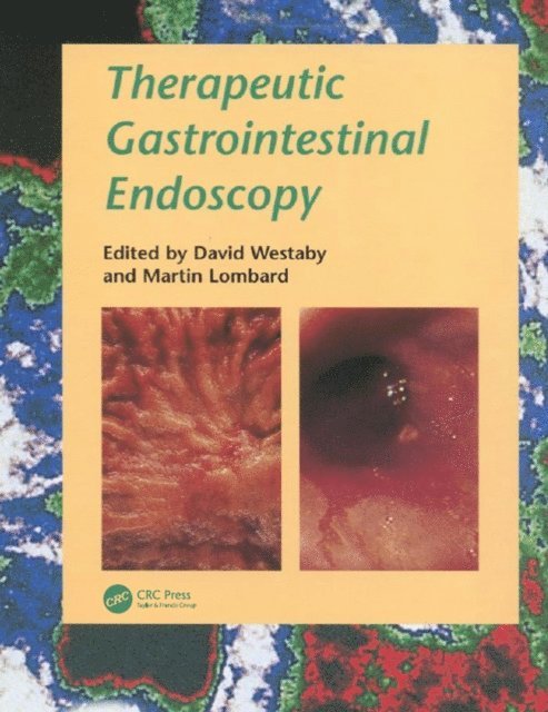 Martin Lombard, David Westaby - Therapeutic Gastrointestinal Endoscopy, E-bok. Tillgänglighet: Lägg i varukorg