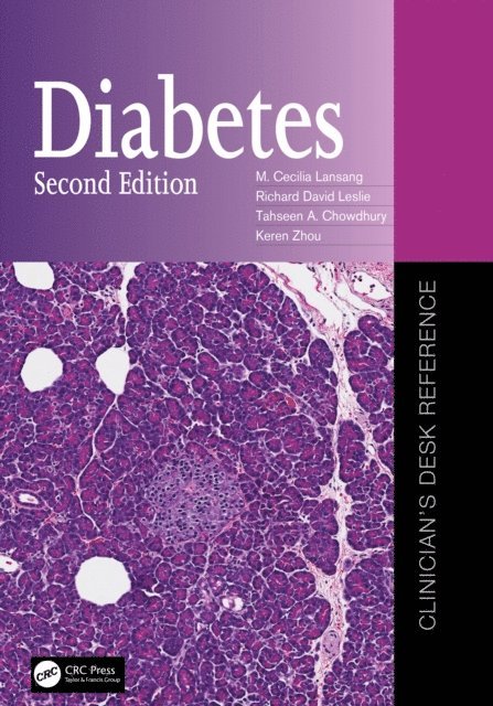 Keren Zhou, Tahseen A. Chowdhury, Richard David Leslie, M. Cecilia Lansang - Diabetes, E-bok