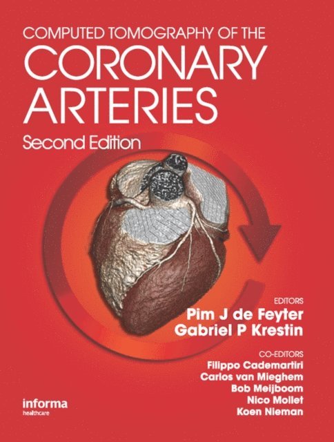 G. P. Gabriel Krestin, Pim J. de Feyter - Computed Tomography of the Coronary Arteries, E-bok