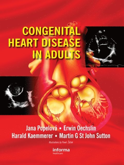 Martin G. St. John Sutton, Harald Kaemmerer, Erwin Oechslin, Jana Popelova - Congenital Heart Disease in Adults, E-bok