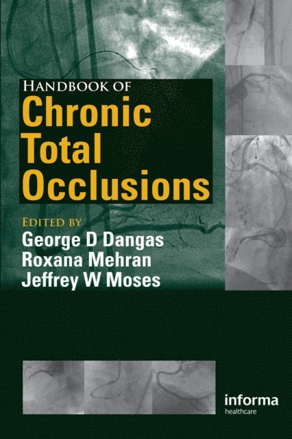 Jeff Moses, Roxana Mehran, George D. Dangas - Handbook of Chronic Total Occlusions, E-bok